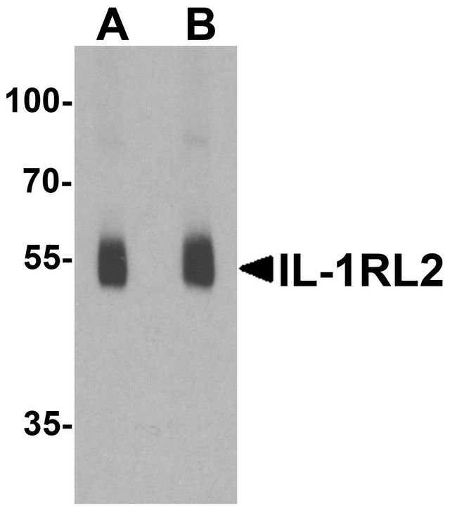 IL1RL2 Antibody - Western blot analysis of IL-1RL2 in human small intestine lysate with IL-1RL2 antibody at (A) 1 and (B) 2 ug/ml.