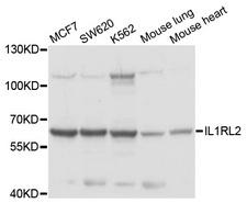 IL1RL2 Antibody - Western blot analysis of extracts of various cell lines, using IL1RL2 antibody at 1:1000 dilution. The secondary antibody used was an HRP Goat Anti-Rabbit IgG (H+L) at 1:10000 dilution. Lysates were loaded 25ug per lane and 3% nonfat dry milk in TBST was used for blocking. An ECL Kit was used for detection and the exposure time was 15s.