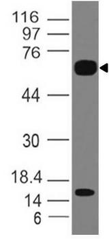 IL1RL2 Antibody - Fig-1: Western blot analysis of IL-36R. Anti-IL-36R antibody was tested at 2 µg/ml on human Small Intestine lysate.