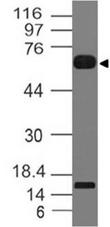 IL1RL2 Antibody - Fig-1: Western blot analysis of IL-36R. Anti-IL-36R antibody was tested at 2 µg/ml on human Small Intestine lysate.