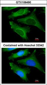 IL1RN Antibody - Immunofluorescence of methanol-fixed HeLa using IL1ra antagonist antibody at 1:200 dilution.