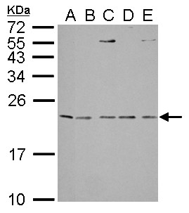 IL1RN Antibody - IL1 Receptor antagonist antibody detects IL1RN protein by Western blot analysis. A. 30 ug Neuro2A whole lysate/extract. B. 30 ug C8D30 whole cell lysate/extract. C. 30 ug NIH-3T3 whole cell lysate/extract. D. 30 ug Raw264.7 whole cell lysate/extract. E. 30 ug C2C12 whole cell lysate/extract. 15 % SDS-PAGE. IL1 Receptor antagonist antibody dilution:1:1000