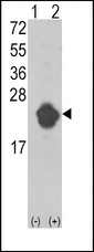 IL1RN Antibody - Western blot of IL1RN (arrow) using rabbit polyclonal IL1RN Antibody. 293 cell lysates (2 ug/lane) either nontransfected (Lane 1) or transiently transfected with the IL1RN gene (Lane 2) (Origene Technologies).