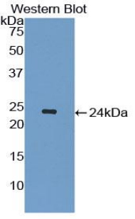 IL1RN Antibody - Western blot of recombinant IL1RN.  This image was taken for the unconjugated form of this product. Other forms have not been tested.