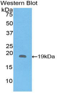 IL1RN Antibody - Western blot of recombinant IL1RN.  This image was taken for the unconjugated form of this product. Other forms have not been tested.