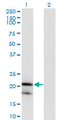 IL1RN Antibody - Western blot of IL1RN expression in transfected 293T cell line by IL1RN monoclonal antibody (M03), clone 1H5.