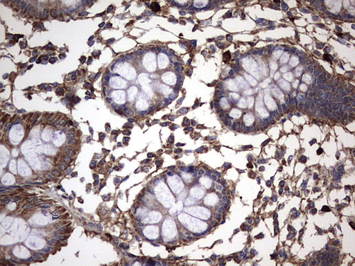 IL1RN Antibody - IHC of paraffin-embedded Human colon tissue using anti-IL1RN mouse monoclonal antibody. (Heat-induced epitope retrieval by 1 mM EDTA in 10mM Tris, pH8.5, 120°C for 3min).