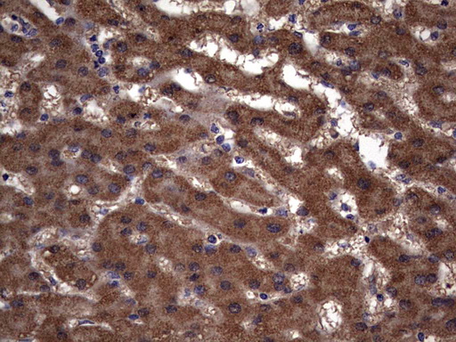IL1RN Antibody - IHC of paraffin-embedded Human liver tissue using anti-IL1RN mouse monoclonal antibody. (Heat-induced epitope retrieval by 1 mM EDTA in 10mM Tris, pH8.5, 120°C for 3min).