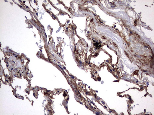 IL1RN Antibody - IHC of paraffin-embedded Human lung tissue using anti-IL1RN mouse monoclonal antibody. (Heat-induced epitope retrieval by 1 mM EDTA in 10mM Tris, pH8.5, 120°C for 3min).