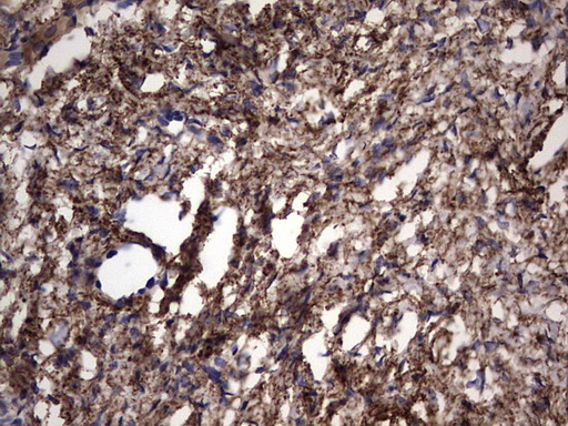 IL1RN Antibody - IHC of paraffin-embedded Human Ovary tissue using anti-IL1RN mouse monoclonal antibody. (Heat-induced epitope retrieval by 1 mM EDTA in 10mM Tris, pH8.5, 120°C for 3min).