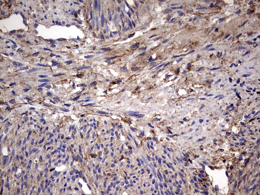 IL1RN Antibody - IHC of paraffin-embedded Human endometrium tissue using anti-IL1RN mouse monoclonal antibody. (Heat-induced epitope retrieval by 1 mM EDTA in 10mM Tris, pH8.5, 120°C for 3min).