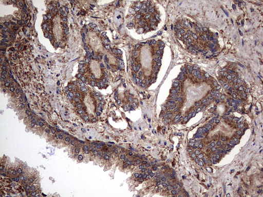 IL1RN Antibody - IHC of paraffin-embedded Human prostate tissue using anti-IL1RN mouse monoclonal antibody. (Heat-induced epitope retrieval by 1 mM EDTA in 10mM Tris, pH8.5, 120°C for 3min).