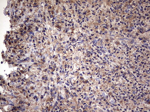 IL1RN Antibody - IHC of paraffin-embedded Human lymph node tissue using anti-IL1RN mouse monoclonal antibody. (Heat-induced epitope retrieval by 1 mM EDTA in 10mM Tris, pH8.5, 120°C for 3min).