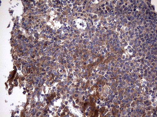 IL1RN Antibody - IHC of paraffin-embedded Human tonsil using anti-IL1RN mouse monoclonal antibody. (Heat-induced epitope retrieval by 1 mM EDTA in 10mM Tris, pH8.5, 120°C for 3min).