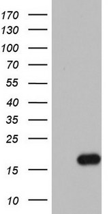 IL1RN Antibody - HEK293T cells were transfected with the pCMV6-ENTRY control (Left lane) or pCMV6-ENTRY IL1RN (Right lane) cDNA for 48 hrs and lysed. Equivalent amounts of cell lysates (5 ug per lane) were separated by SDS-PAGE and immunoblotted with anti-IL1RN.