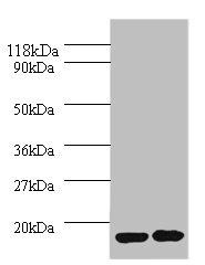IL1RN Antibody - Western blot All lanes: Interleukin-1 receptor antagonist antibody at 2µg/ml Lane 1: EC109 whole cell lysate Lane 2: 293T whole cell lysate Secondary Goat polyclonal to rabbit IgG at 1/10000 dilution Predicted band size: 21, 18, 20, 17 kDa Observed band size: 17 kDa