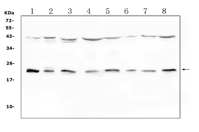 IL1RN Antibody - Western blot analysis of IL1RA using anti-IL1RA antibody. Electrophoresis was performed on a 5-20% SDS-PAGE gel at 70V (Stacking gel) / 90V (Resolving gel) for 2-3 hours. The sample well of each lane was loaded with 50ug of sample under reducing conditions. Lane 1: human Hela whole cell lysate,Lane 2: human COLO-320 whole cell lysate,Lane 3: human HepG2 whole cell lysate,Lane 4: human Jurkat whole cell lysate,Lane 5: human K562 whole cell lysate,Lane 6: human HT1080 whole cell lysate,Lane 7: human U20S whole cell lysate,Lane 8: human PANC-1 whole cell lysate. After Electrophoresis, proteins were transferred to a Nitrocellulose membrane at 150mA for 50-90 minutes. Blocked the membrane with 5% Non-fat Milk/ TBS for 1.5 hour at RT. The membrane was incubated with rabbit anti-IL1RA antigen affinity purified polyclonal antibody at 0.5 µg/mL overnight at 4°C, then washed with TBS-0.1% Tween 3 times with 5 minutes each and probed with a goat anti-rabbit IgG-HRP secondary antibody at a dilution of 1:10000 for 1.5 hour at RT. The signal is developed using an Enhanced Chemiluminescent detection (ECL) kit with Tanon 5200 system. A specific band was detected for IL1RA at approximately 23KD. The expected band size for IL1RA is at 20KD.