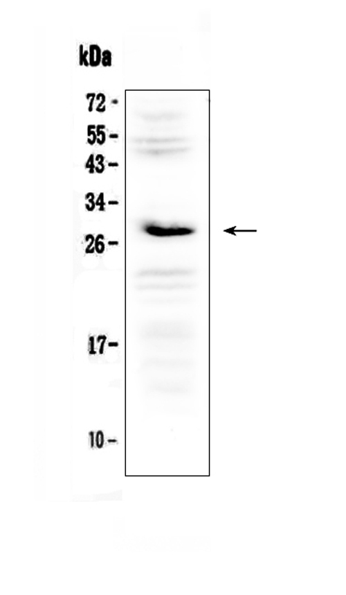 IL1RN Antibody - Western blot analysis of IL1RA using anti-IL1RA antibody. Electrophoresis was performed on a 5-20% SDS-PAGE gel at 70V (Stacking gel) / 90V (Resolving gel) for 2-3 hours. The sample well of each lane was loaded with 50ug of sample under reducing conditions. Lane 1: rat testis tissue lysate. After Electrophoresis, proteins were transferred to a Nitrocellulose membrane at 150mA for 50-90 minutes. Blocked the membrane with 5% Non-fat Milk/ TBS for 1.5 hour at RT. The membrane was incubated with rabbit anti-IL1RA antigen affinity purified polyclonal antibody at 0.5 µg/mL overnight at 4°C, then washed with TBS-0.1% Tween 3 times with 5 minutes each and probed with a goat anti-rabbit IgG-HRP secondary antibody at a dilution of 1:10000 for 1.5 hour at RT. The signal is developed using an Enhanced Chemiluminescent detection (ECL) kit with Tanon 5200 system. A specific band was detected for IL1RA at approximately 28KD. The expected band size for IL1RA is at 20KD.