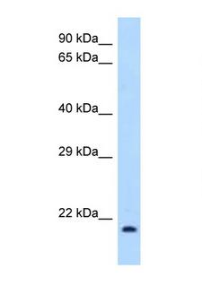 IL1RN Antibody - IL1RN / IL-1RA antibody Western blot of 293T Cell lysate. Antibody concentration 1 ug/ml.  This image was taken for the unconjugated form of this product. Other forms have not been tested.