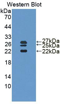 IL1RN Antibody - Western Blot; Sample: Recombinant protein.