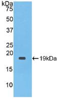 IL1RN Antibody