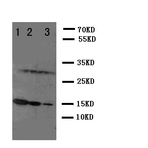 IL2 Antibody - WB of IL2 antibody. Lane 1: Recombinant Mouse IL2 Protein 10ng . Lane 2: Recombinant Mouse IL2 Protein 5ng. Lane 3: Recombinant Mouse IL2 Protein 2.5ng.