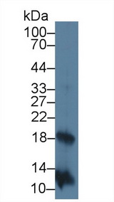 IL2 Antibody - Western Blot; Sample: Rat Stomach lysate; Primary Ab: 3µg/ml Mouse Anti-Human IL2 Antibody Second Ab: 0.2µg/mL HRP-Linked Caprine Anti-Mouse IgG Polyclonal Antibody