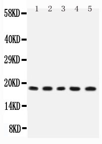 IL2 Antibody - WB of IL2 antibody. All lanes: Anti-IL2 at 0.5ug/ml. Lane 1: Rat Thymus Tissue Lysate at 40ug. Lane 2: Rat Liver Tissue Lysate at 40ug. Lane 3: NRK Whole Cell Lysate at 40ug. Lane 4: PC12 Whole Cell Lysate at 40ug. Lane 5: RH35 Whole Cell Lysate at 40ug. Predicted bind size: 18KD. Observed bind size: 18KD.