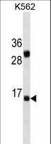 IL2 Antibody - IL2 Antibody (Ascites)western blot of K562 cell line lysates (35 ug/lane). The IL2 antibody detected the IL2 protein (arrow).