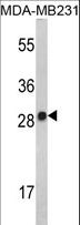IL2 Antibody - Western blot of IL2 Antibody in MDA-MB231 cell line lysates (35 ug/lane). IL2 (arrow) was detected using the purified antibody.