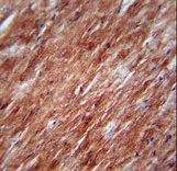 IL2 Antibody - IL2 Antibody immunohistochemistry of formalin-fixed and paraffin-embedded mouse heart tissue followed by peroxidase-conjugated secondary antibody and DAB staining.
