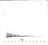 IL2 Antibody - Western Blot (non-reducing) of IL-2 antibody. This image was taken for the unconjugated form of this product. Other forms have not been tested.