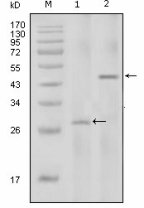IL2 Antibody - Western blot of IL2 mouse mAb against full-length IL2 recombinant protein with Trx tag (1) and full-length IL2-hIgGFc transfected HEK293 cell lysate(2).