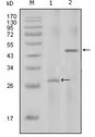IL2 Antibody - Western blot analysis using IL2 mouse mAb against full-length IL2 recombinant protein with Trx tag (1) and full-length IL2-hIgGFc transfected HEK293 cell lysate(2).