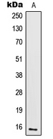 IL2 Antibody - Western blot analysis of IL-2 expression in CTLL2 (A) whole cell lysates.