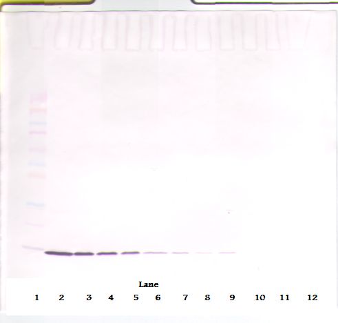 IL2 Antibody - Western Blot (non-reducing) of IL-2 antibody