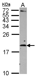 IL2 Antibody - Sample (30 ug of whole cell lysate) A: Raji 15% SDS PAGE IL-2 antibody diluted at 1:500