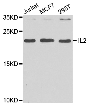 IL2 Antibody - Western blot analysis of extracts of various cell lines, using IL2 antibody at 1:1000 dilution. The secondary antibody used was an HRP Goat Anti-Rabbit IgG (H+L) at 1:10000 dilution. Lysates were loaded 25ug per lane and 3% nonfat dry milk in TBST was used for blocking. An ECL Kit was used for detection and the exposure time was 10s.