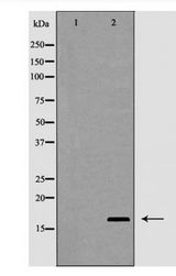 IL2 Antibody - Western blot of Interleukin?2 expression in HT-29 cells