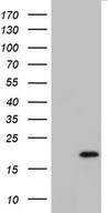 IL20 Antibody - HEK293T cells were transfected with the pCMV6-ENTRY control (Left lane) or pCMV6-ENTRY IL20 (Right lane) cDNA for 48 hrs and lysed. Equivalent amounts of cell lysates (5 ug per lane) were separated by SDS-PAGE and immunoblotted with anti-IL20.