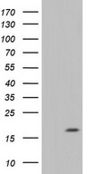IL20 Antibody - HEK293T cells were transfected with the pCMV6-ENTRY control (Left lane) or pCMV6-ENTRY IL20 (Right lane) cDNA for 48 hrs and lysed. Equivalent amounts of cell lysates (5 ug per lane) were separated by SDS-PAGE and immunoblotted with anti-IL20.