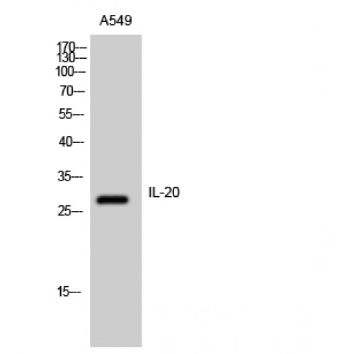 IL20 Antibody - Western blot of IL-20 antibody