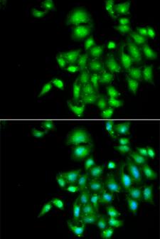 IL20 Antibody - Immunofluorescence analysis of A549 cell using IL20 antibody. Blue: DAPI for nuclear staining.