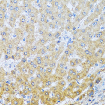 IL20 Antibody - Immunohistochemistry of paraffin-embedded human liver tissue.