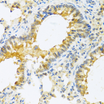 IL20 Antibody - Immunohistochemistry of paraffin-embedded mouse lung tissue.