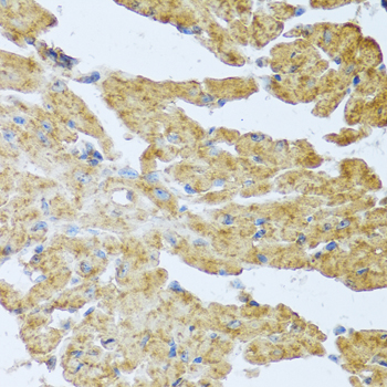 IL20 Antibody - Immunohistochemistry of paraffin-embedded mouse heart.