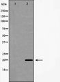 IL20 Antibody - Western blot analysis of Interleukin 20 expression in A549 cells. The lane on the left is treated with the antigen-specific peptide.