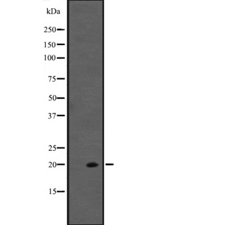 IL20 Antibody - Western blot analysis of IL20 expression in Jurkat cells lysate. The lane on the left is treated with the antigen-specific peptide.
