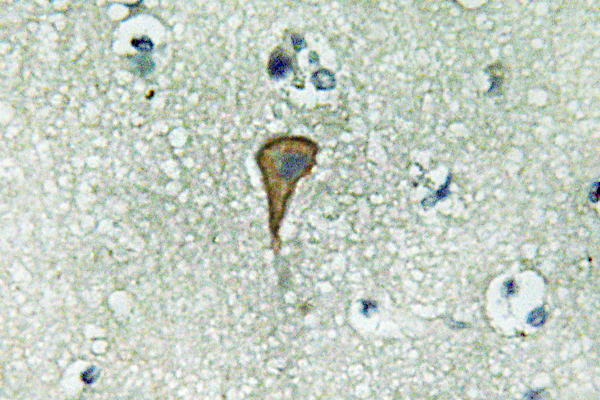 IL20RA Antibody - Immunohistochemistry analysis of IL-20RÎ± antibody in paraffin-embedded human brain tissue.