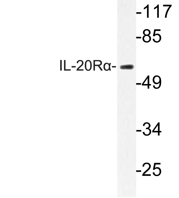 IL20RA Antibody - Western blot analysis of lysate from HepG2 cells, using IL-20RÎ± antibody.